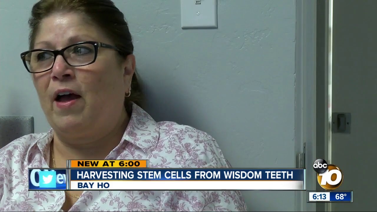 Harvesting stem cells from wisdom teeth