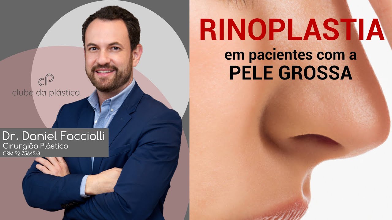 Clube da Plástica: Rinoplastia em pacientes com pele grossa