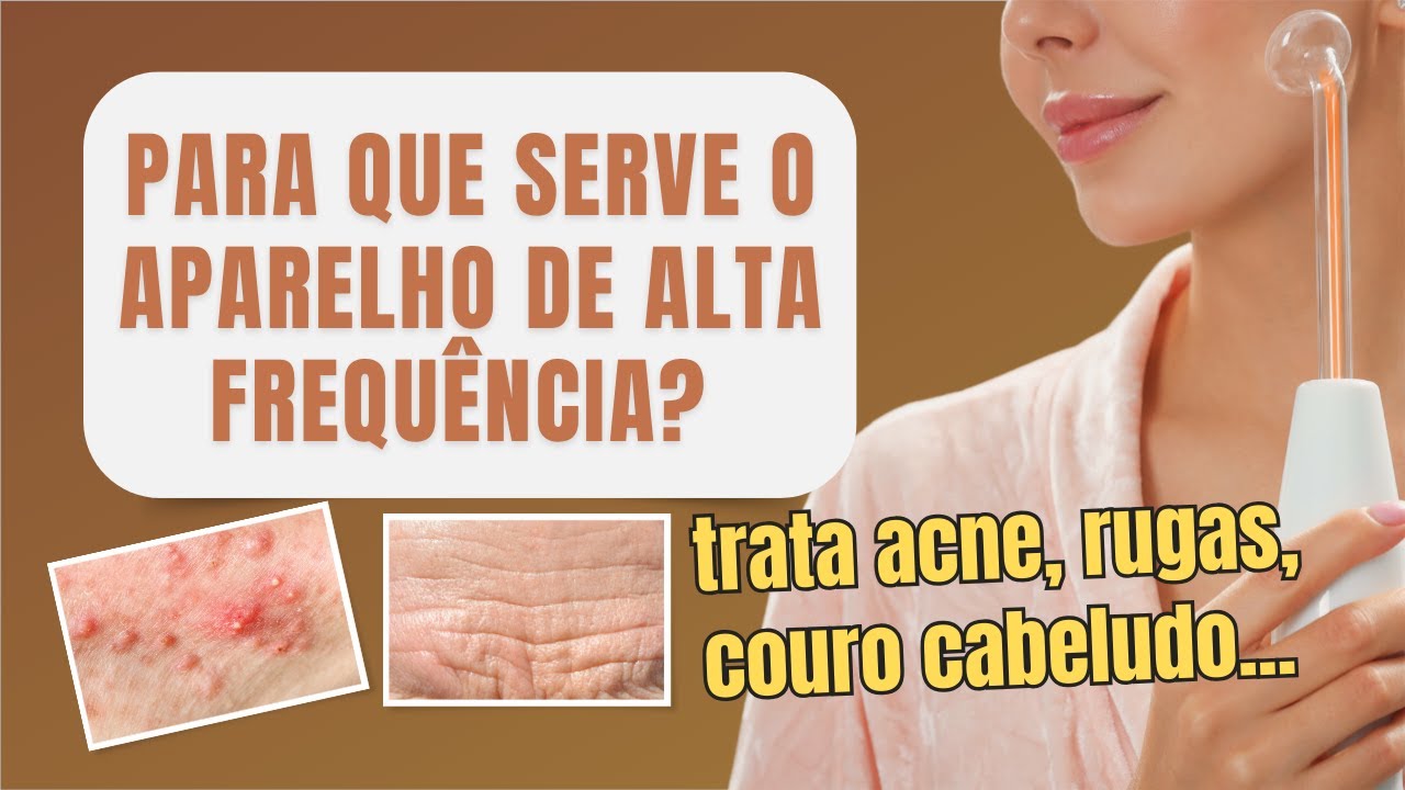 Aparelho de Alta Frequência: Para Que Serve?
