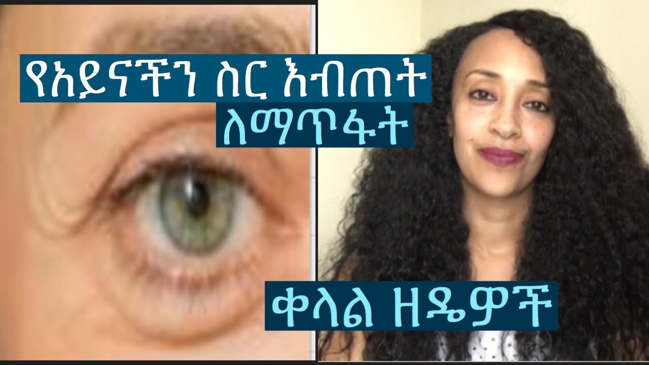 የአይናችን  ስር  እብጠት ለማጥፋት ቀላል ዘዴዎች / easy ways to get rid of puffy under eyes