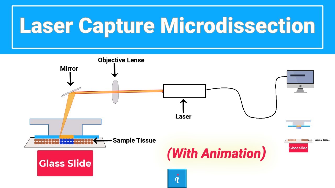 Laser Capture Microdissection (with animation)