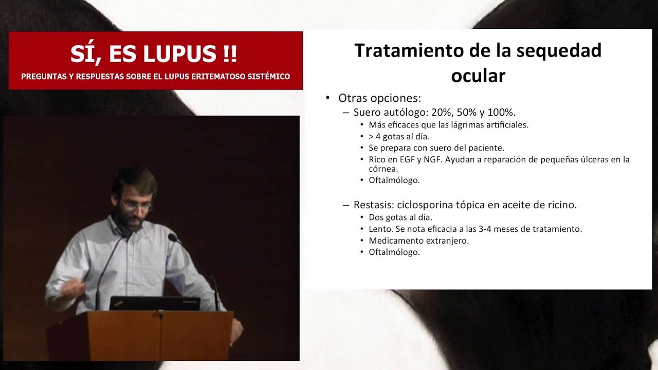 Jose Gabriel Erdozain. Sindrome de Sjögren