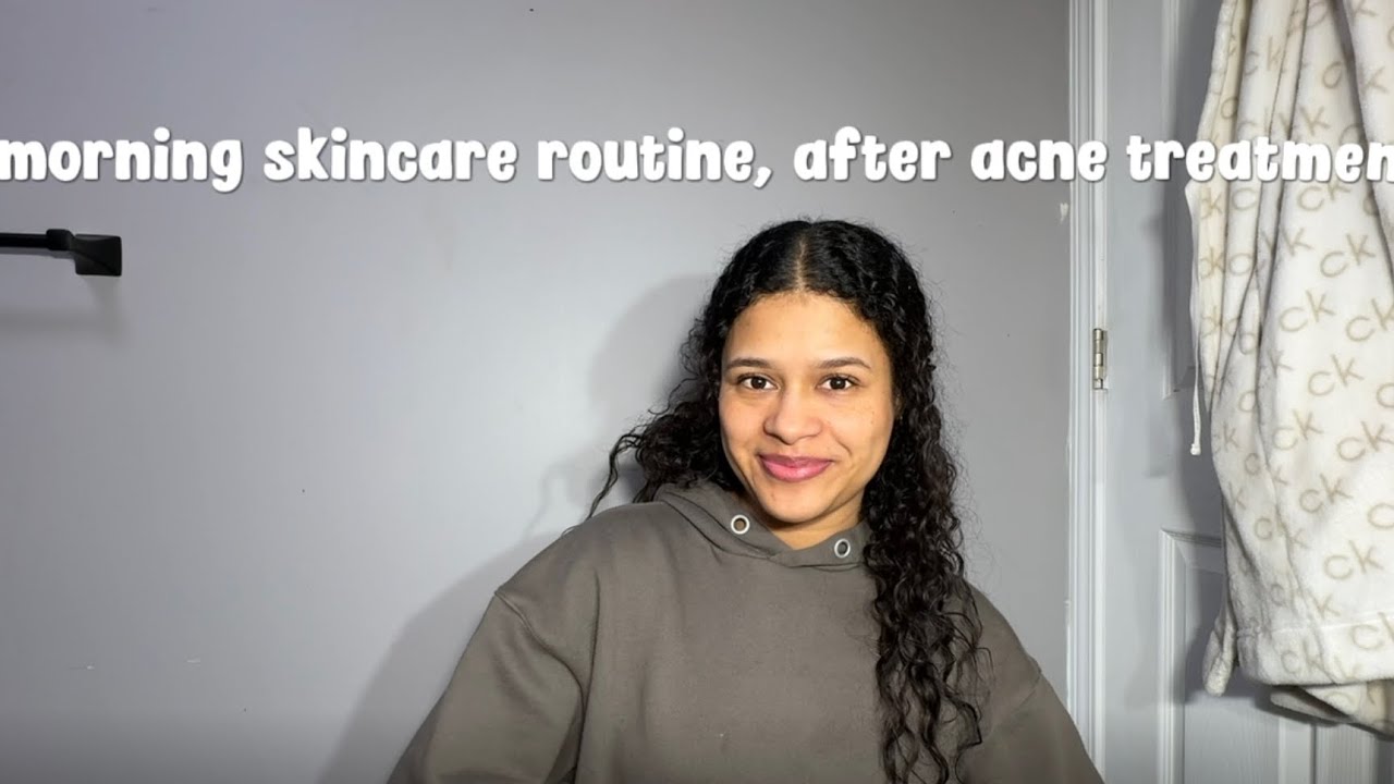 HISTORIA DE MI ACNÉ + RUTINA DE MAÑANA ANTES DE PROBAR SKIN CARE COREANO 
