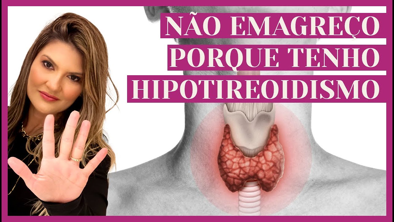 É POSSÍVEL EMAGRECER COM HIPOTIREOIDISMO? | Dra. Etianne Andrade