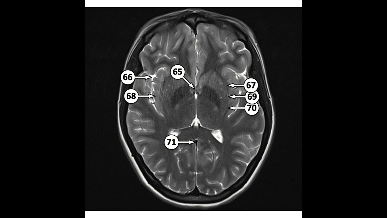 WhatsApp Video 2026 02 28 at 11 12 53 2