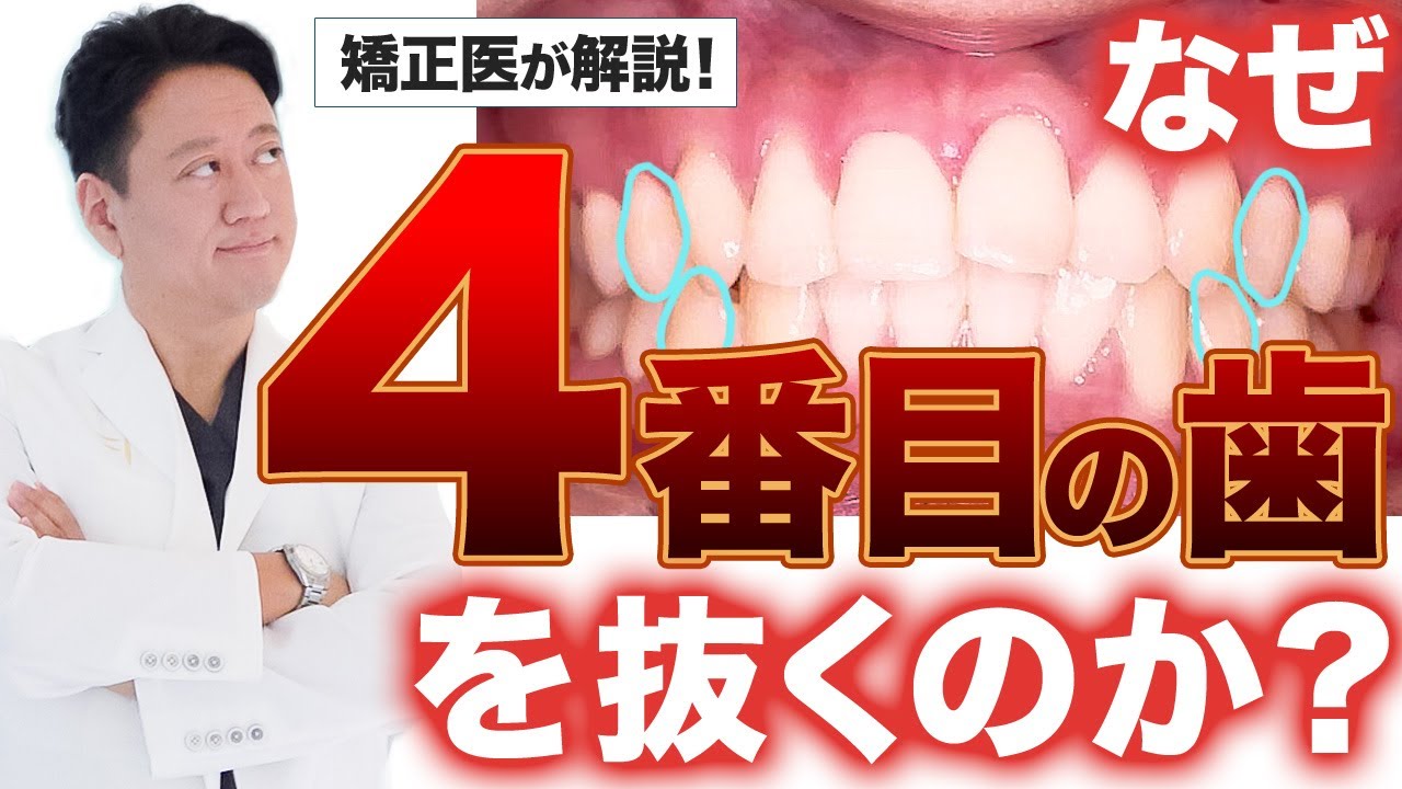 前歯を下げる！矯正で４番の歯を抜く理由と他の歯でも口ゴボを改善できる症例を解説【審美歯科 歯列矯正 Eライン】