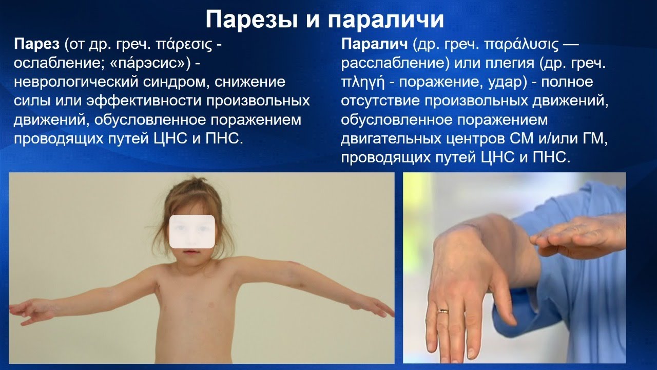 2.29. Массаж при парезах, параличах | Медицинский массаж. Цикл 2