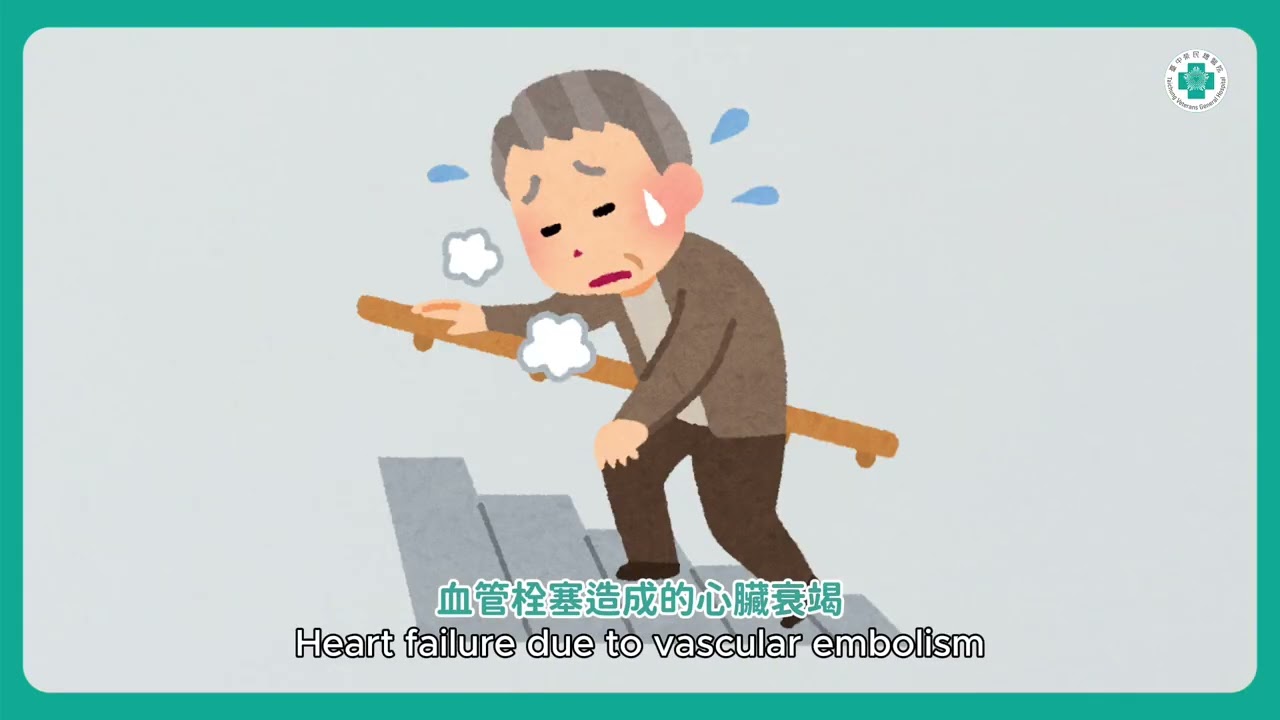 心臟功能剩不到兩成！長效型輔助器神救援│心臟外科 吳詠斯醫師