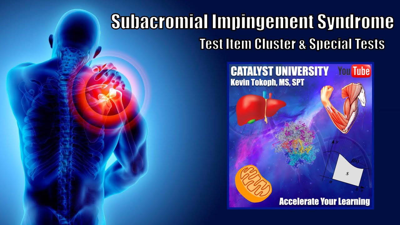 Test Item Cluster | Subacromial Impingement Syndrome EXPLAINED