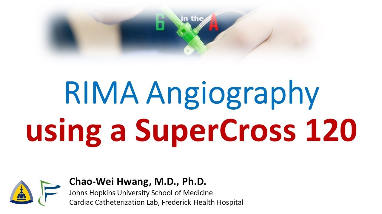 RIMA Angiography using SuperCross angled microcatheter