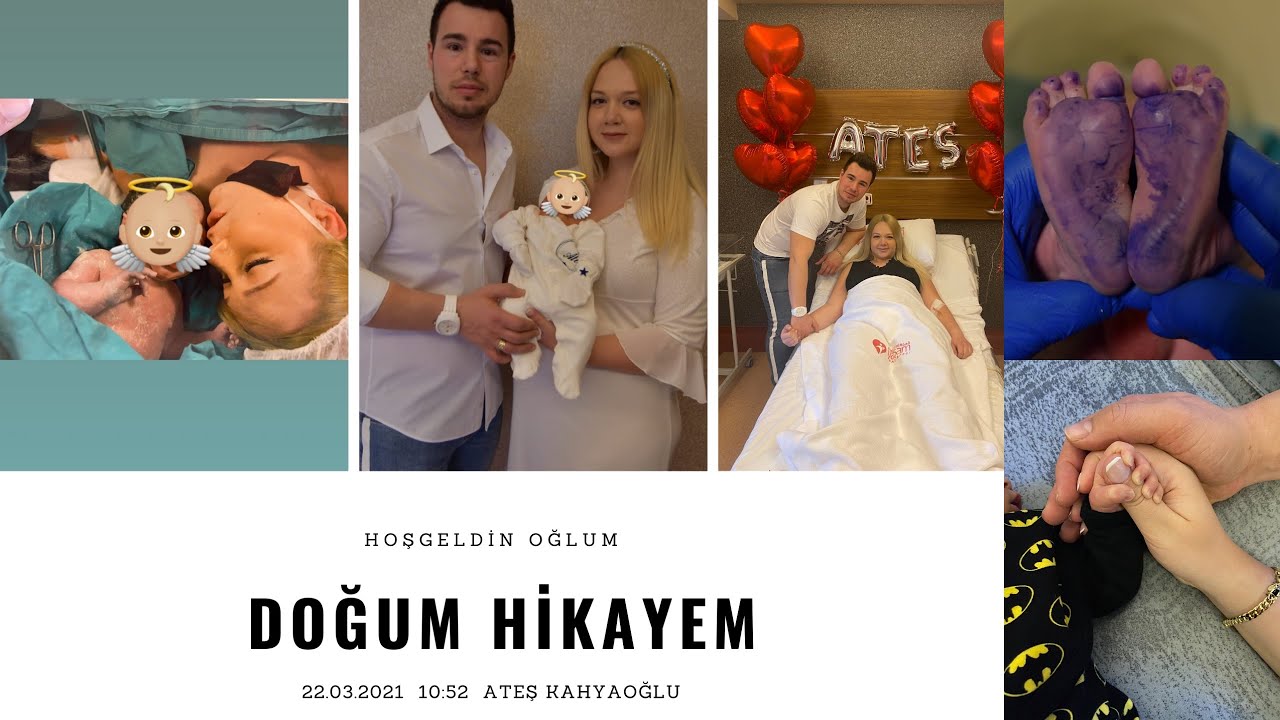 DOĞUM VİDEOM | EPİDURAL SEZERYAN-SPİNAL ANESTEZİ | 39.HAFTADA GELEN MUCİZEM ATEŞ👼🏼 | HASTANE VLOG