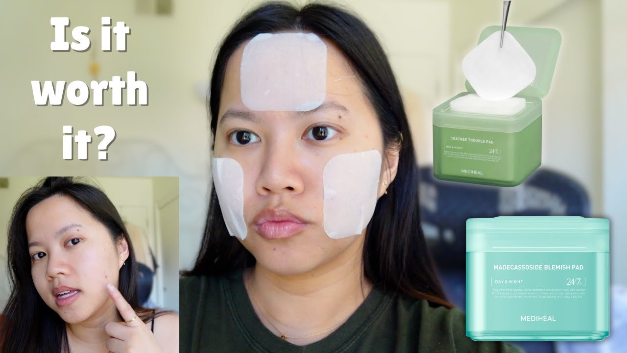 Trying Mediheal Toner Pads for a Week... Worth the Hype? 🤷‍♀️