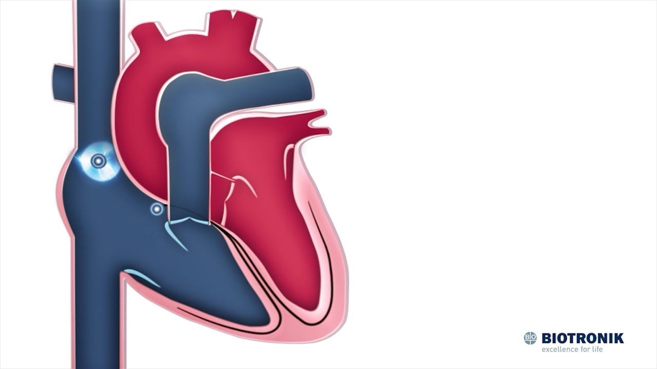 Sistema elettrico del cuore | Animazione medica