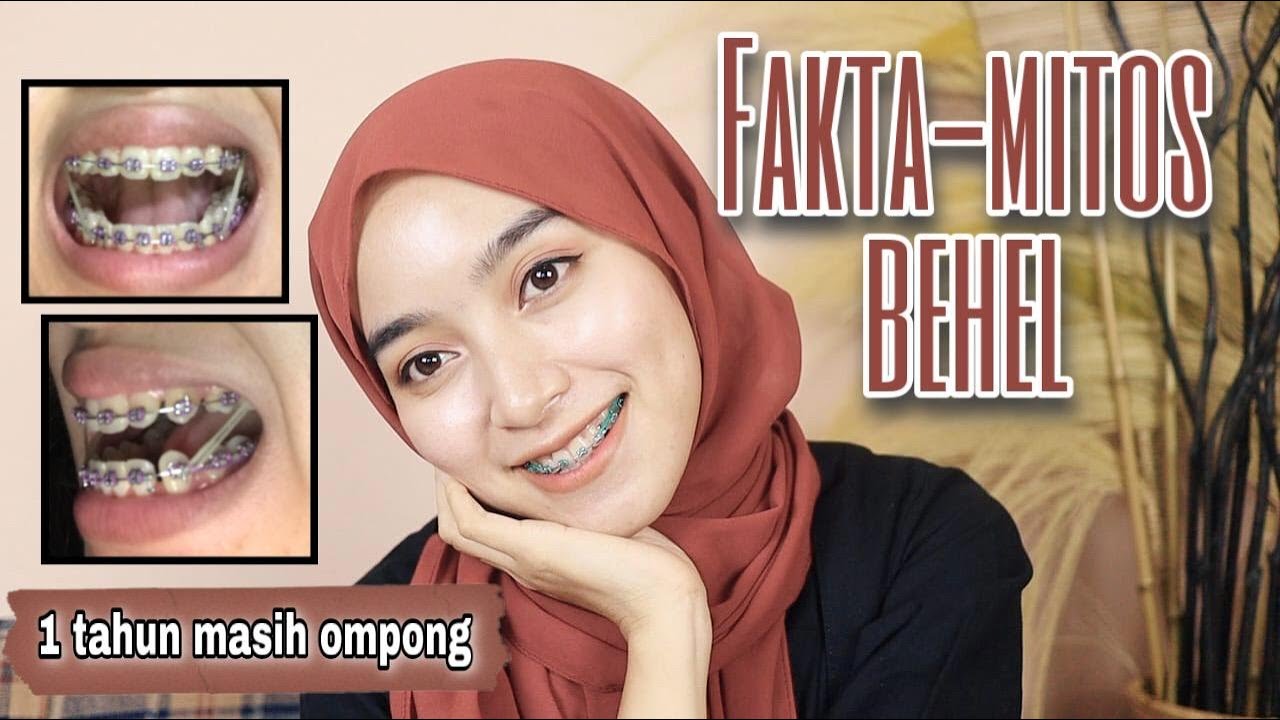 FAKTA MITOS PENGALAMAN PAKAI BEHEL dari gigi BERANTAKAN sampe RAPIH