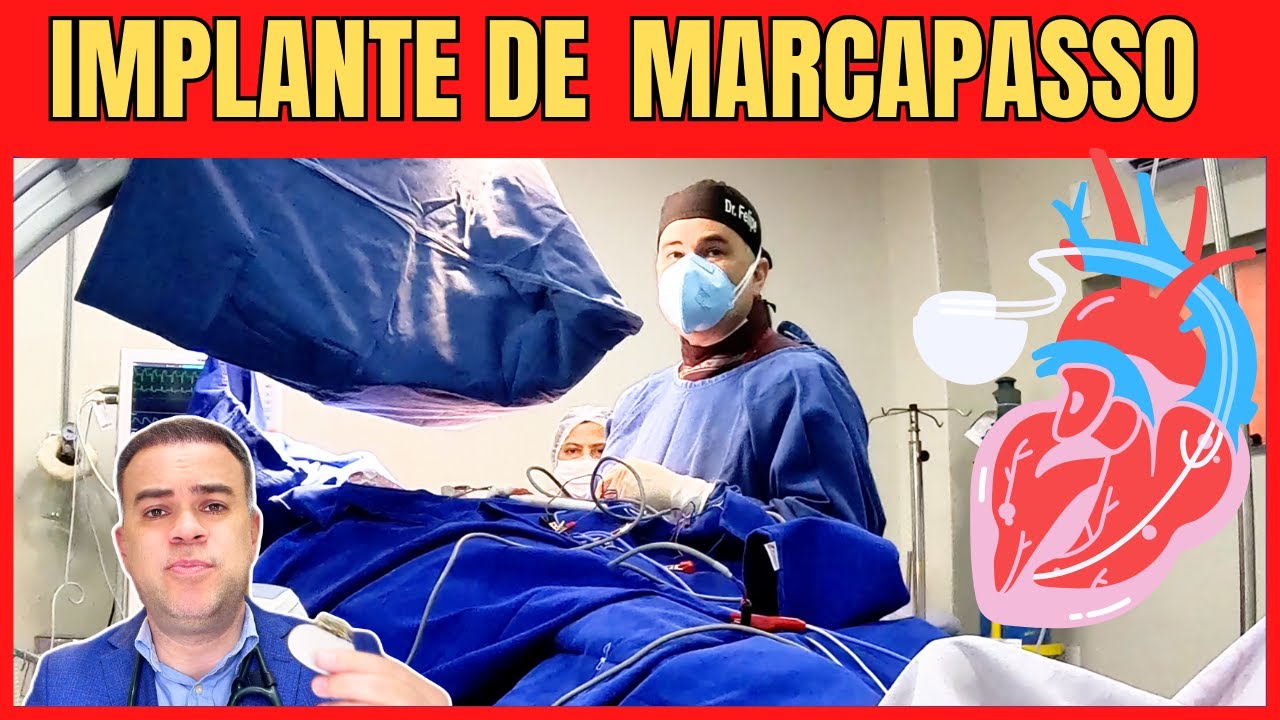 ASSISTA uma CIRURGIA de implante de MARCAPASSO BICAMERAL