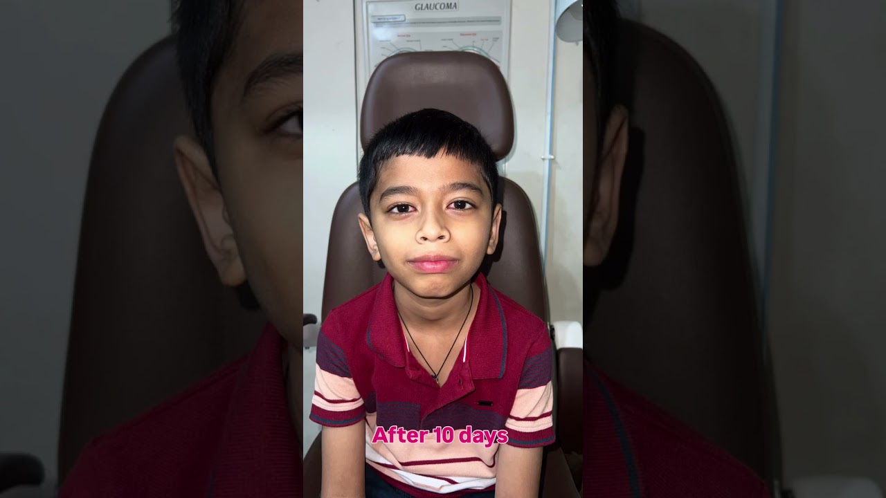 Esotropia & Squint Surgery Strabismus Treatment for Kids  Pediatric Eye Care &ndash; Dr  Ankit Shah