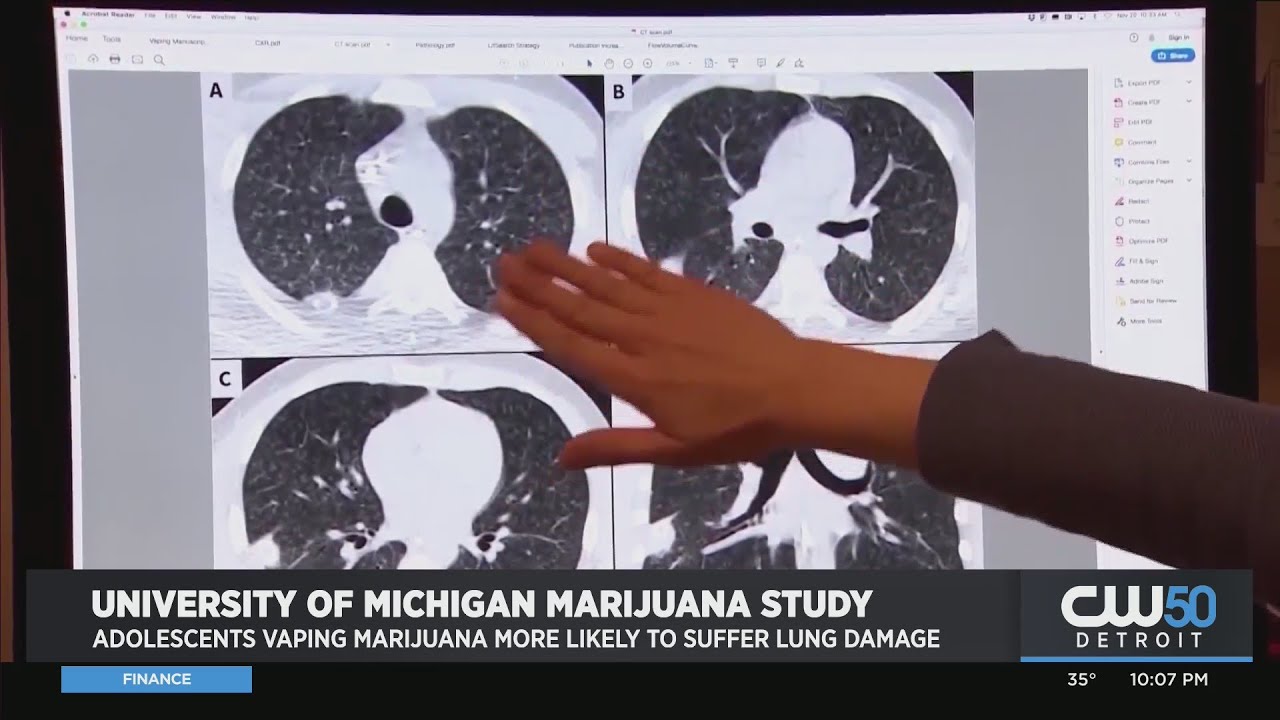 The University of Michigan Research Found Vaping Marijuana Associated with More Lung Damage