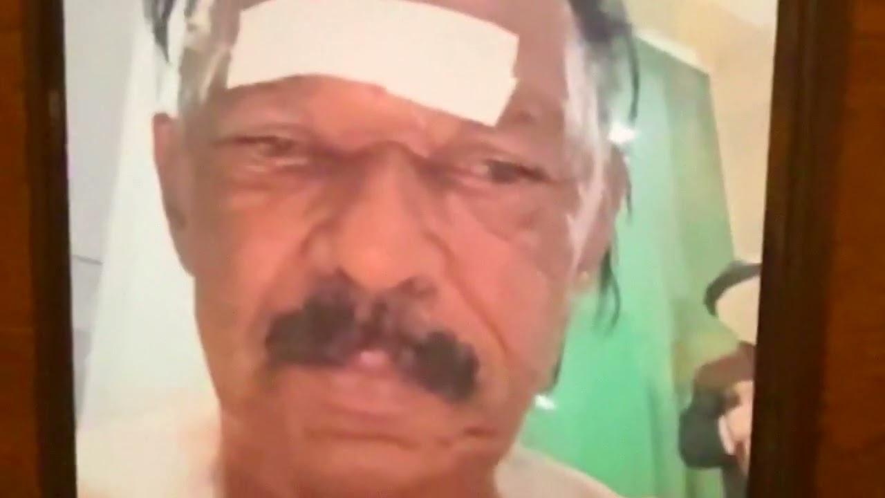 TIRINGA FOI ATINGIDO POR MARRETA E EXPLICA ACIDENTE | TIRINGA RESPONDE