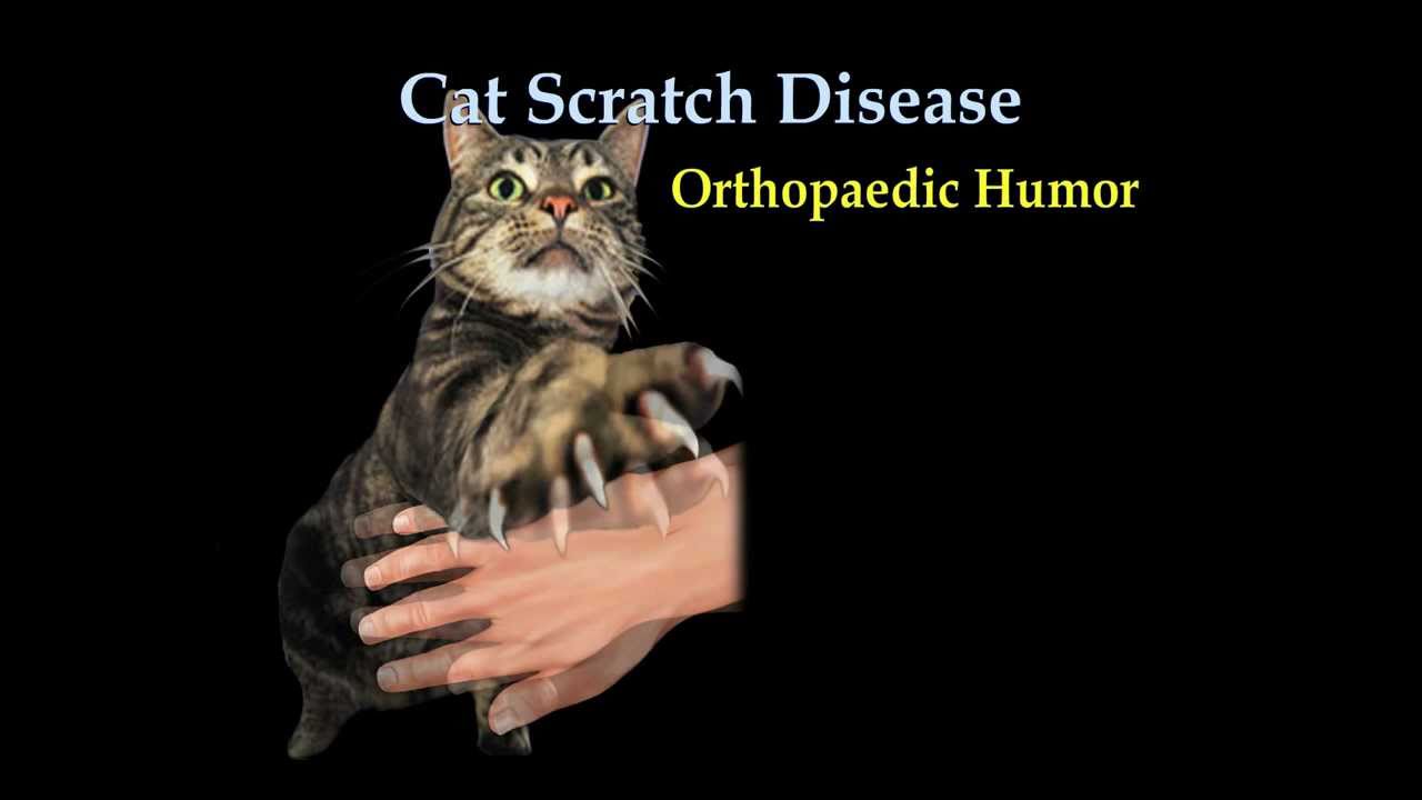Cat Scratch fever  - Everything You Need To Know - Dr. Nabil Ebraheim