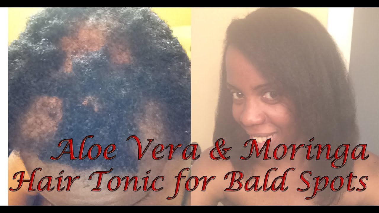 Aloe Vera with Moringa Hair Tonic Tutorial for Bald Spots