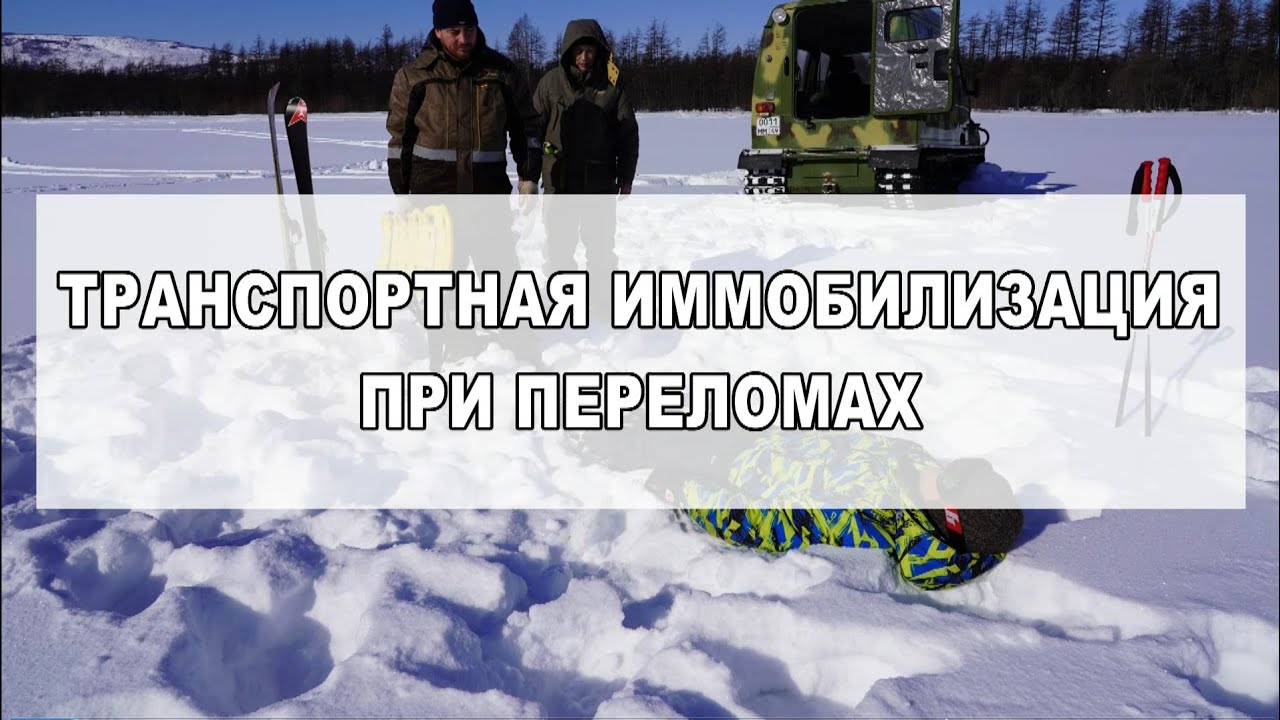 ТРАНСПОРТНАЯ ИММОБИЛИЗАЦИЯ ПРИ ПЕРЕЛОМАХ