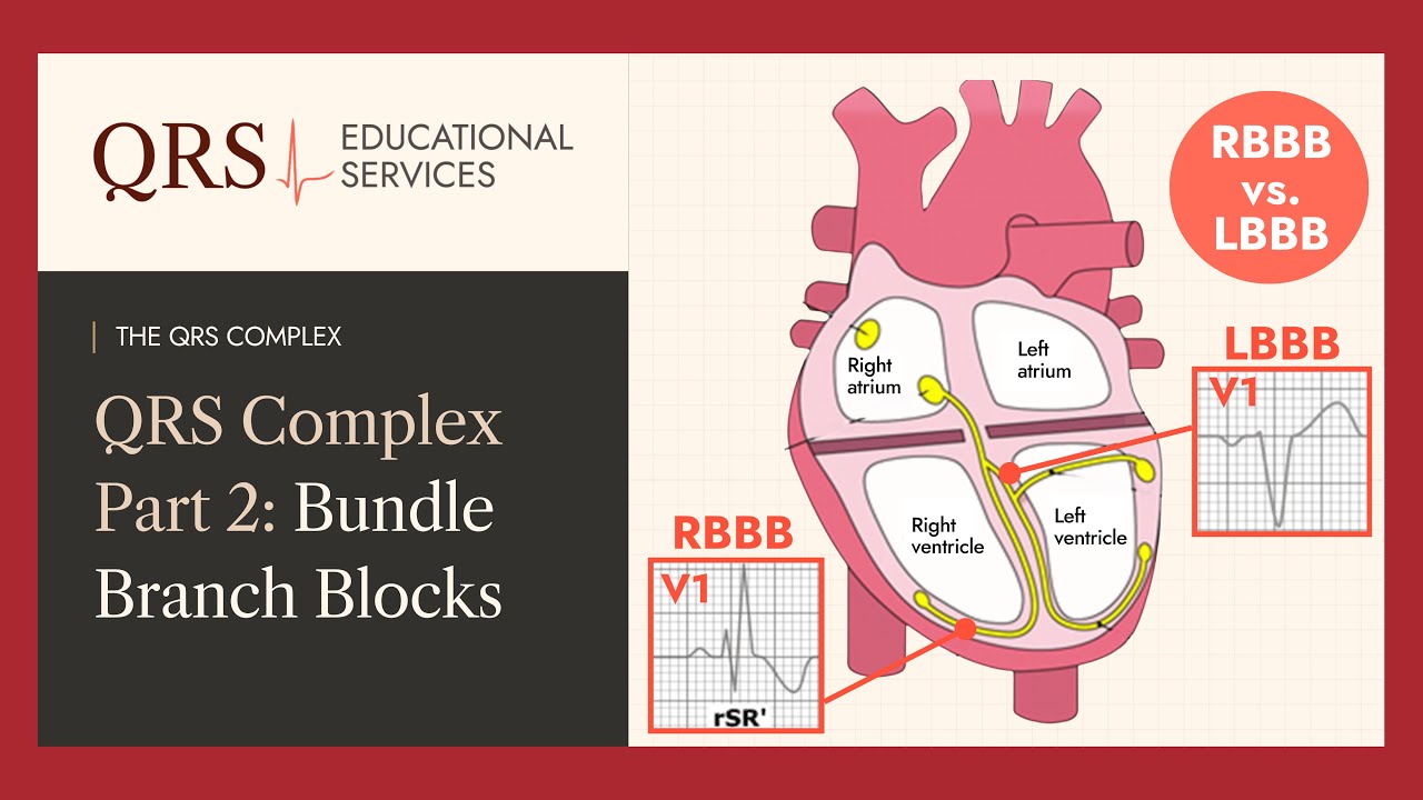 QRS TIPS: The QRS Complex Part 2 - Bundle Branch Blocks | QRS Educational Services