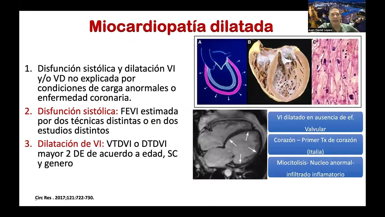 Miocardiopatías | Dr. Juan David López