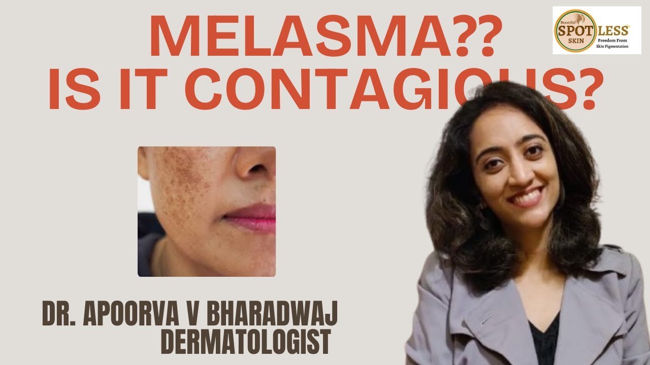 Melasma Myths Busted: Is It Infectious? | Dr. Apoorva V Bharadwaj