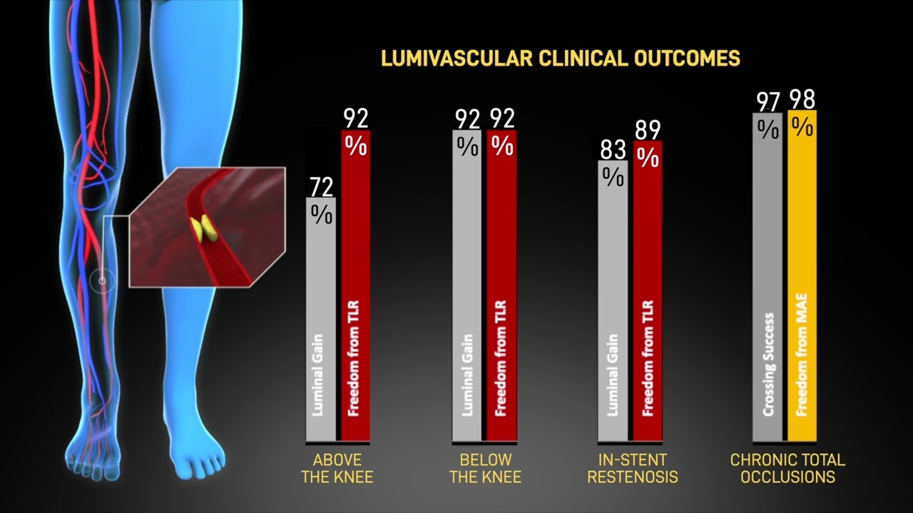 Avinger Lumivascular Explainer Animation