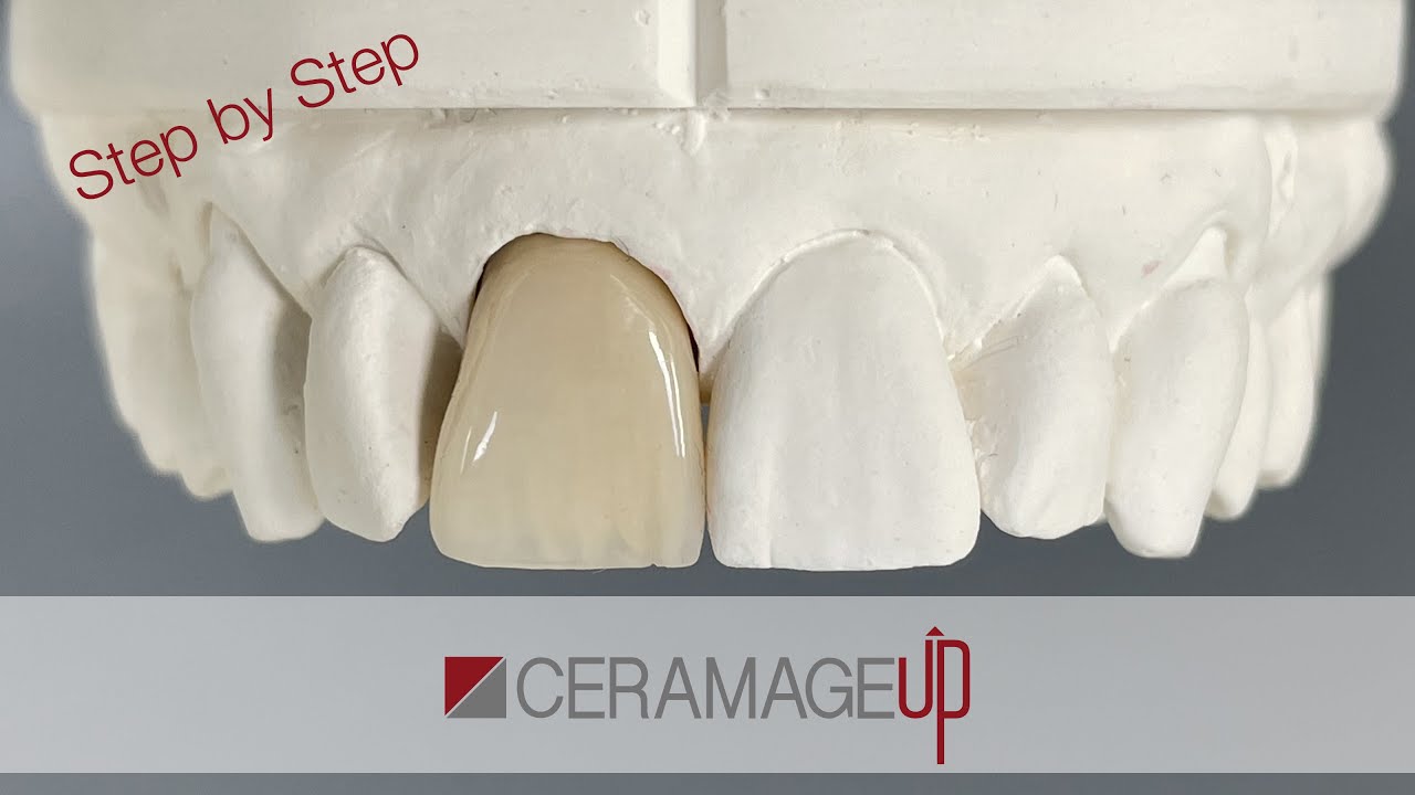 CERAMAGE UP - Step by Step - Version 02
