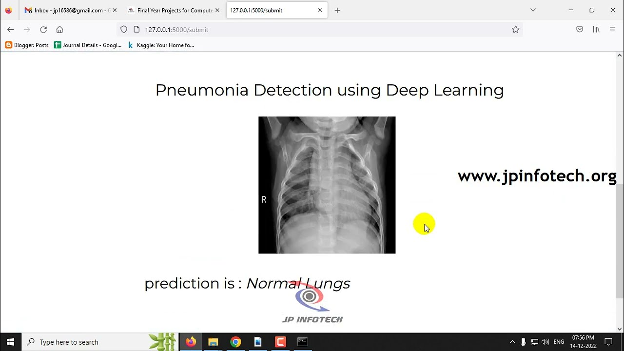 Pneumonia Detection using Deep Learning | Python Final Year IEEE Project