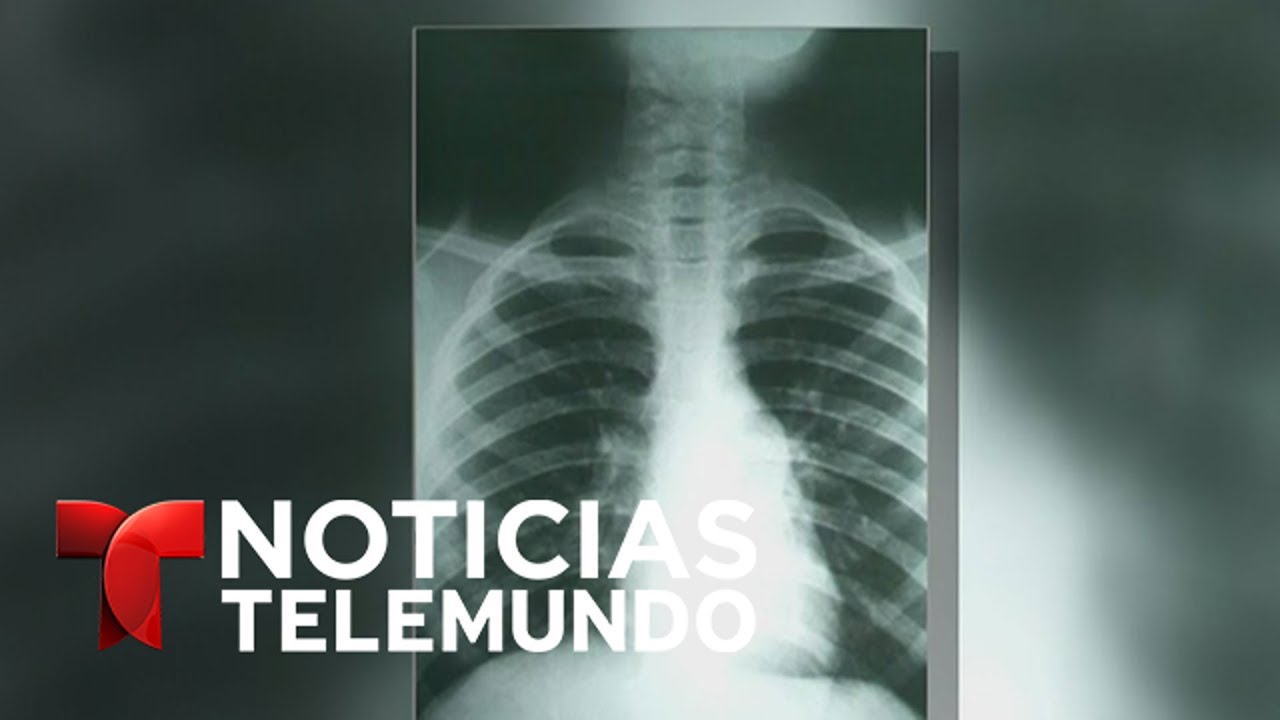 Alerta de salud por la Fiebre del Valle | Noticiero | Noticias Telemundo