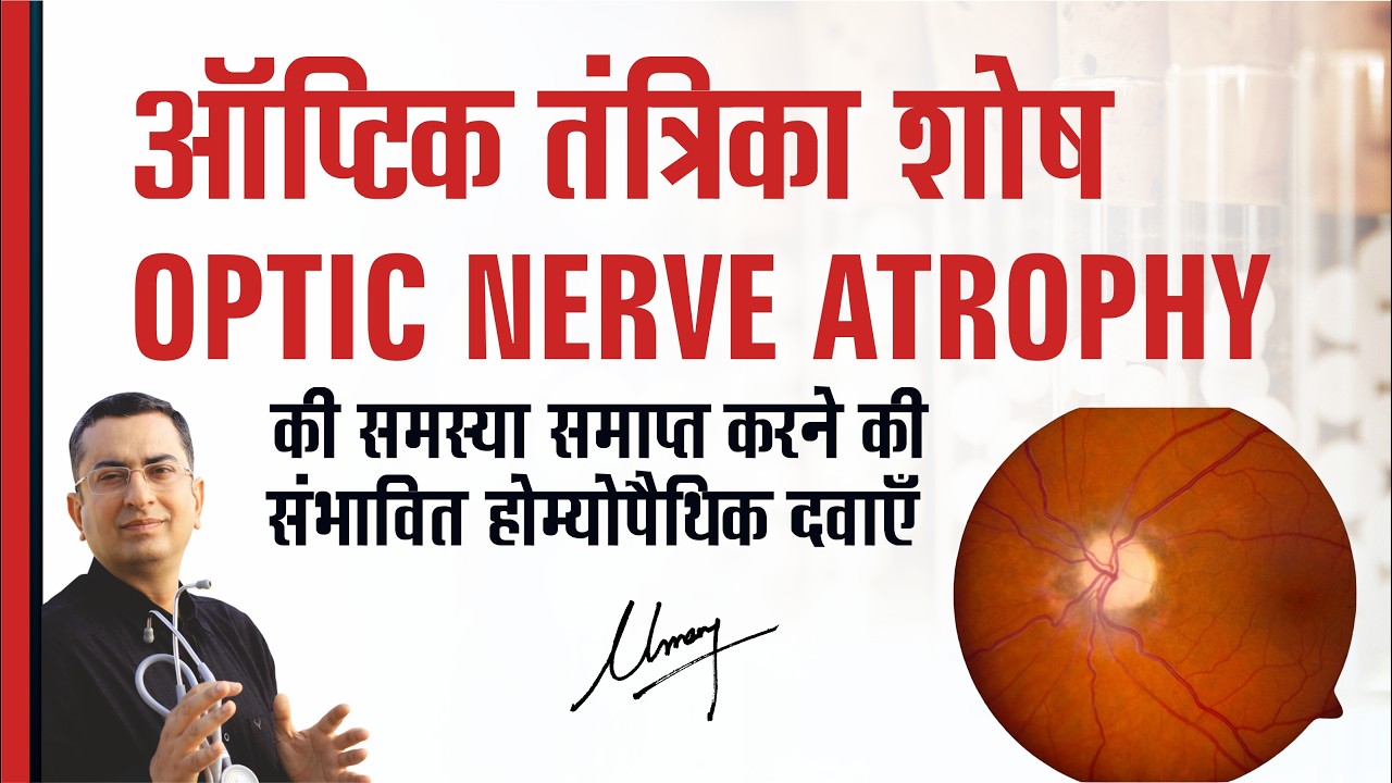 ऑप्टिक तंत्रिका शोष || Optic Nerve Atrophy || Natural homeopathic remedies with symptoms