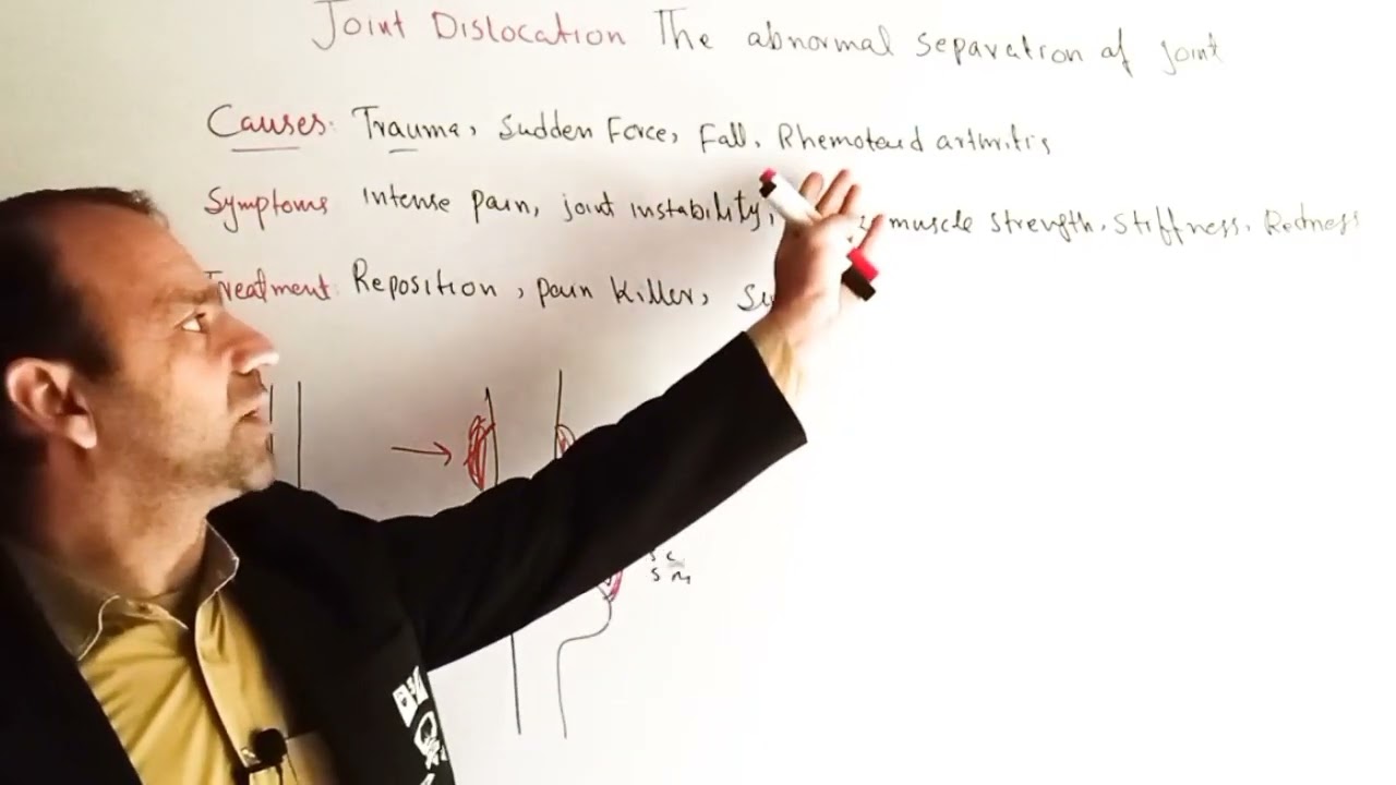 Joint Dislocation | Causes, types, Symptoms and Treatment of Joint Dislocation | Class 12 Biology