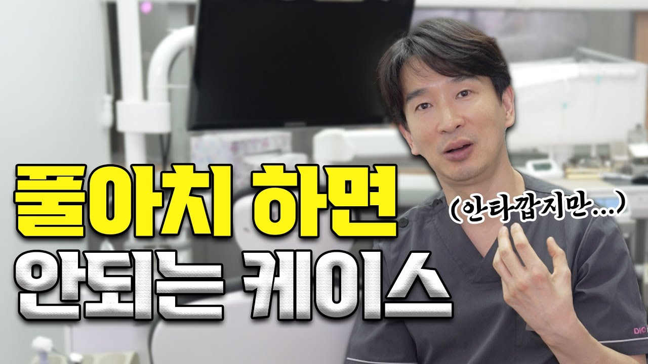 풀아치를 하면 안되는 이유가 있다? #풀아치임플란트 #풀아치 #치과
