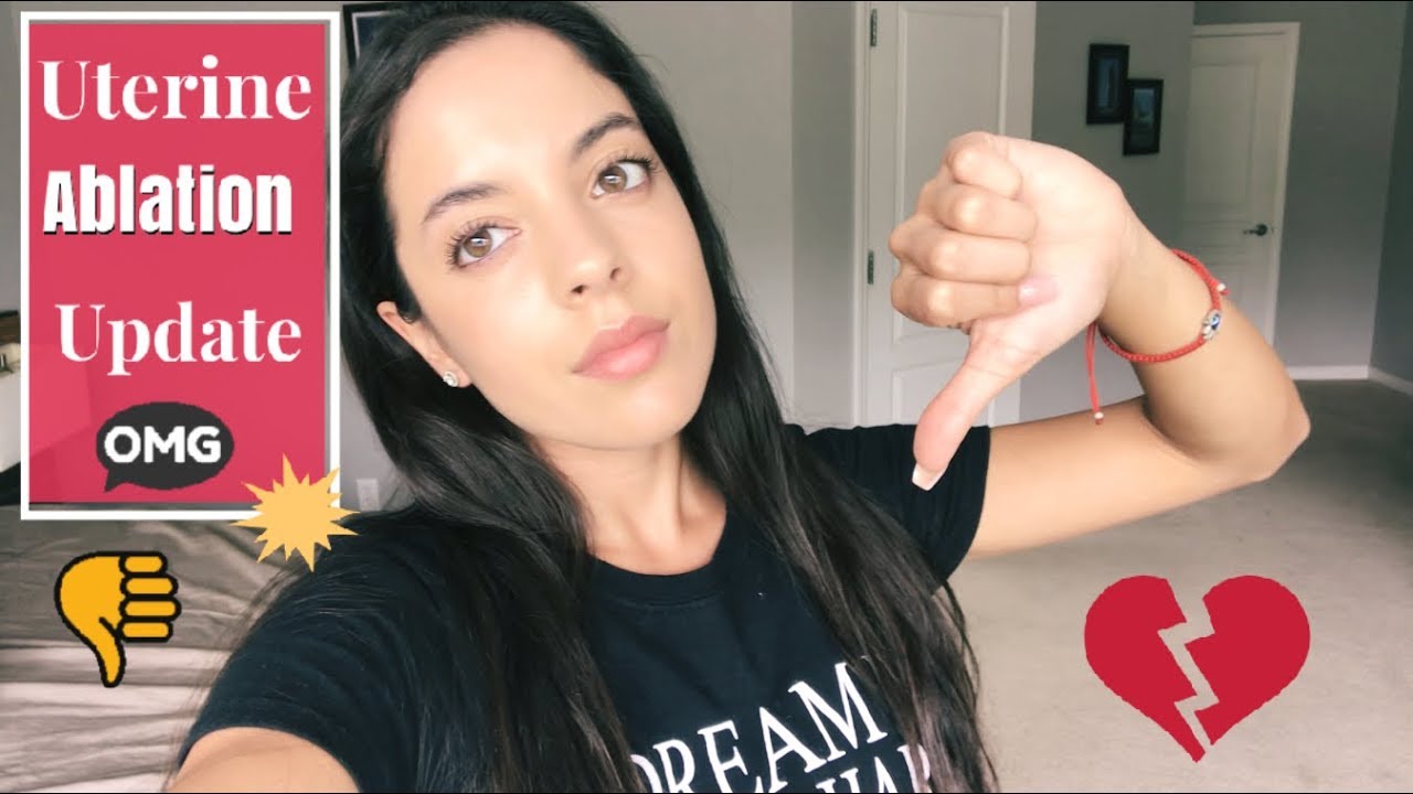 Uterine Ablation Update (Fail)