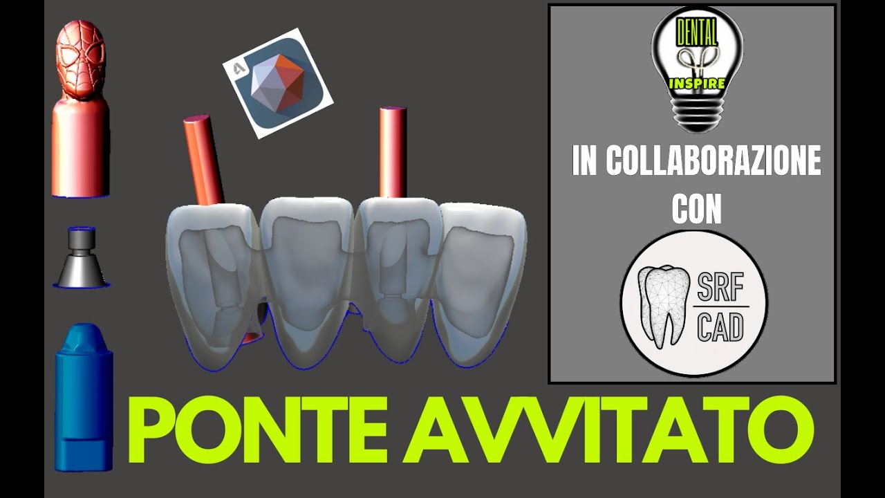 MESHMIXER DENTAL:  FREE IMPLANT WORK =PONTE AVVITATO SU IMPIANTI