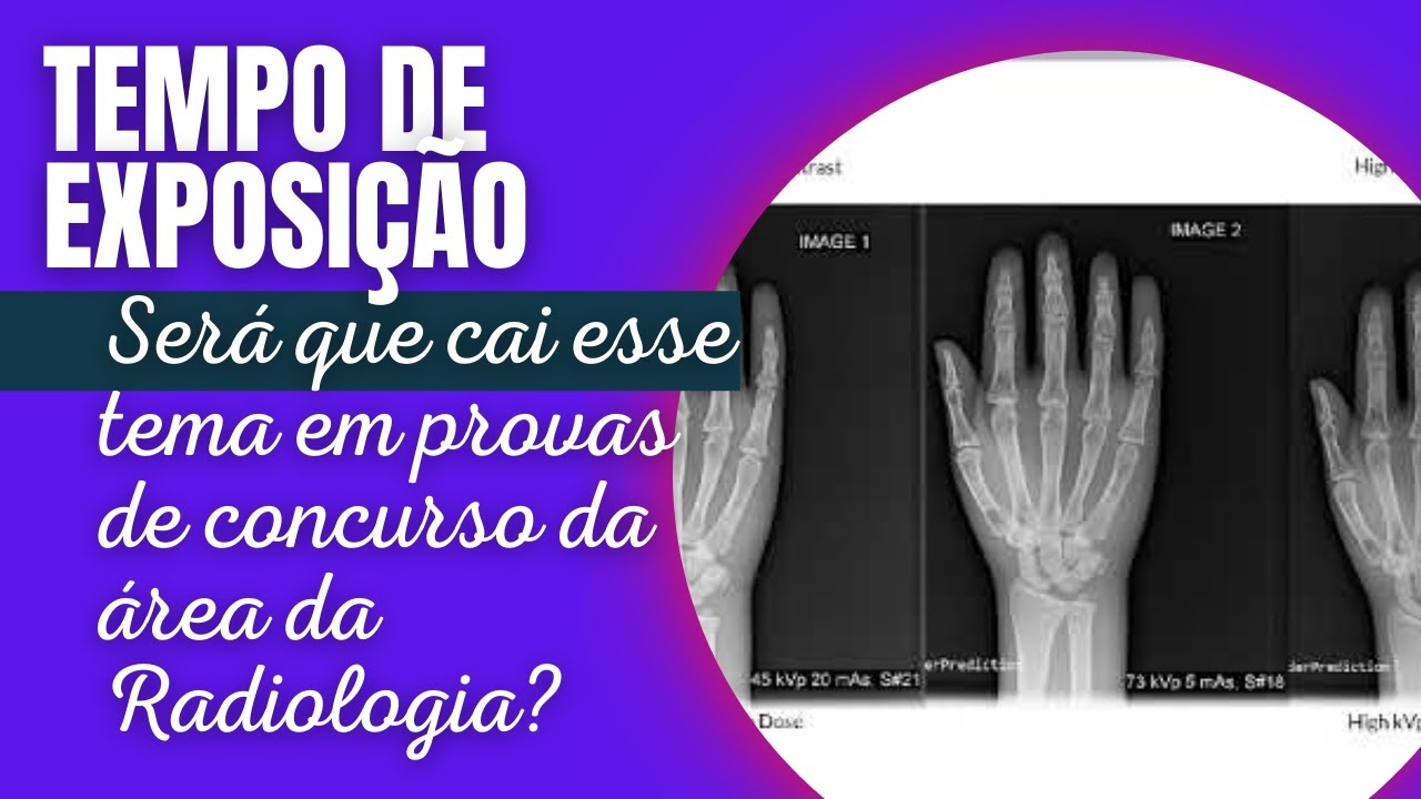 Radiologia - Contraste e densidade radiográfica