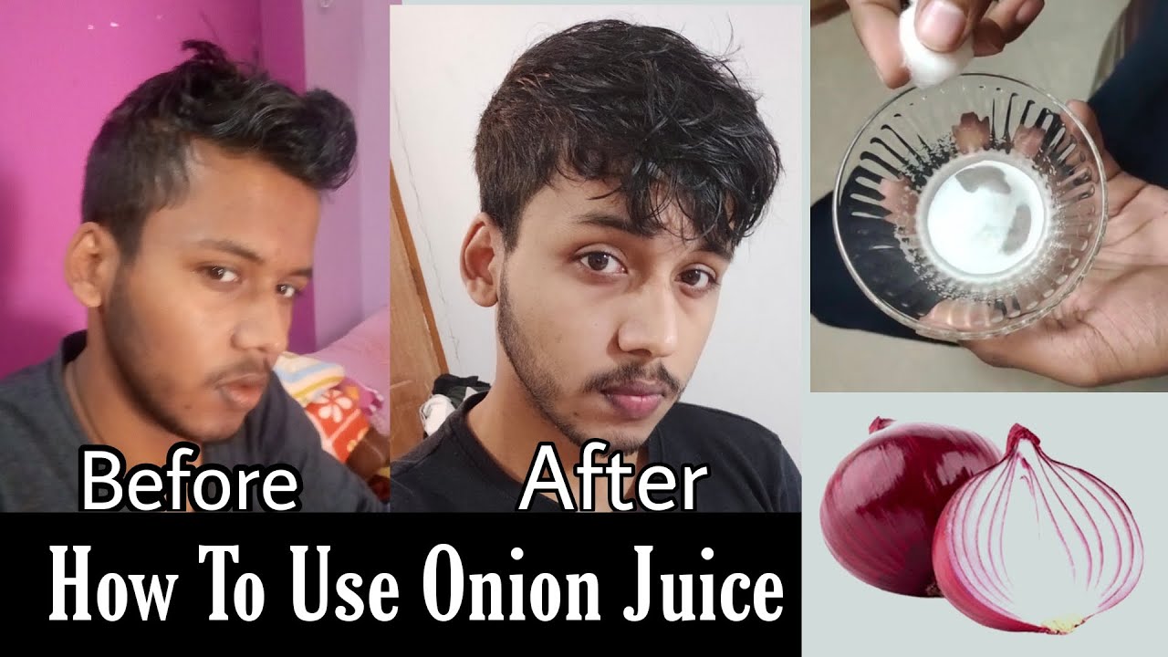 How To Use Onion Juice For Hair Regrowth | Hairfall Control