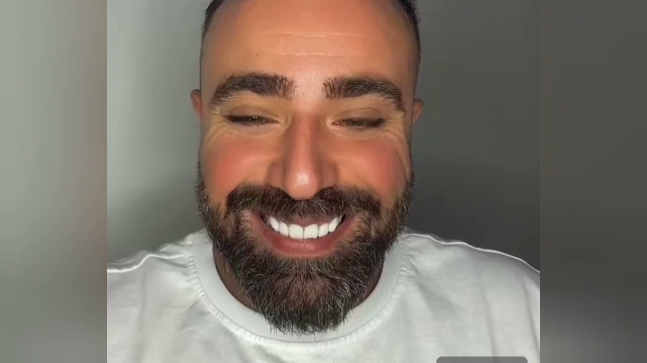 سامي قال علي بدون شخصية😱والبنات يحبونه لأنو نسونجي🤗مشكل لي صار بين علي وسامي‼️