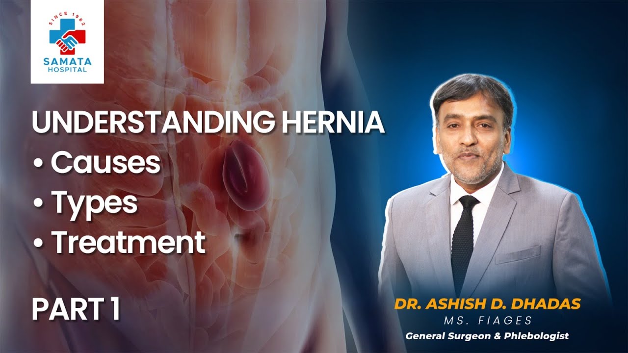 Hernia Alert: Groin Swelling on Standing? Dr. Ashish Dhadas