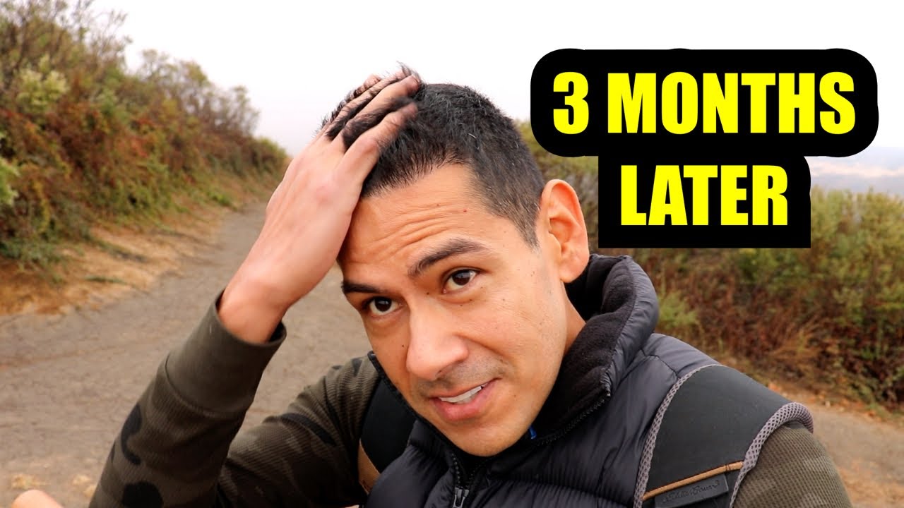 FUE Hair Transplant 3 Months HMR Mexico