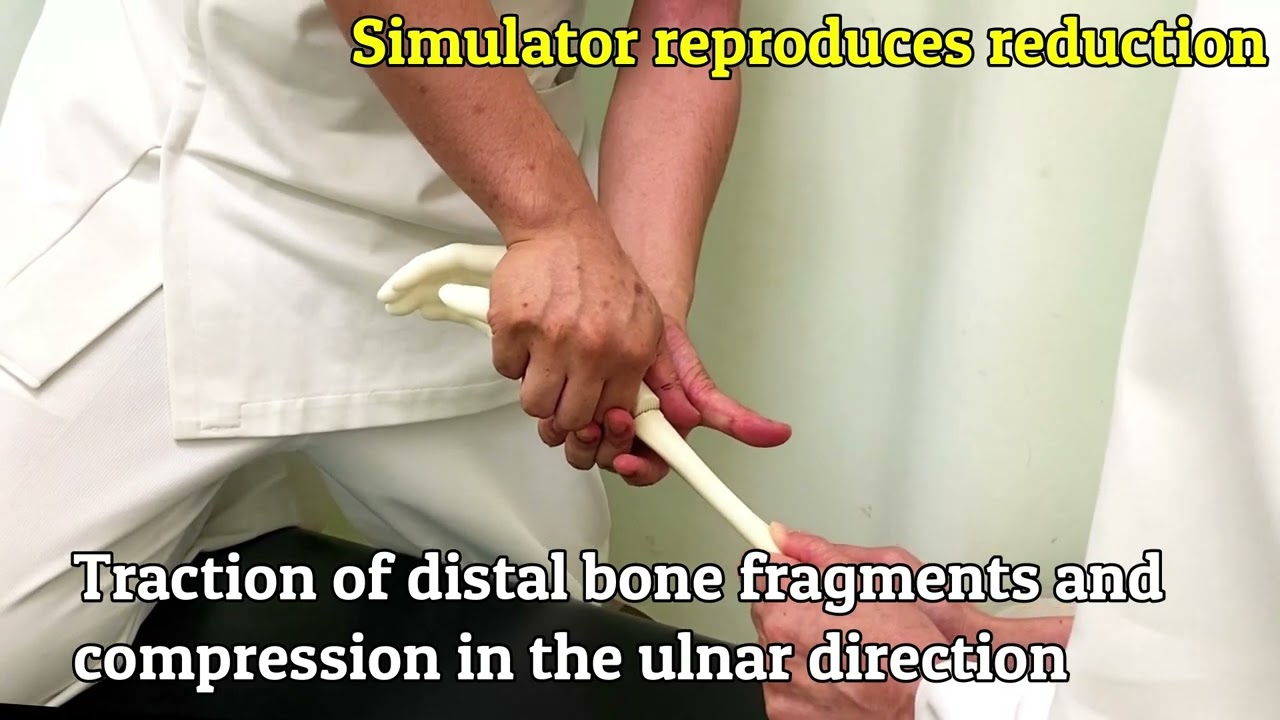 FraDis Colles Fracture Reduction Simulator