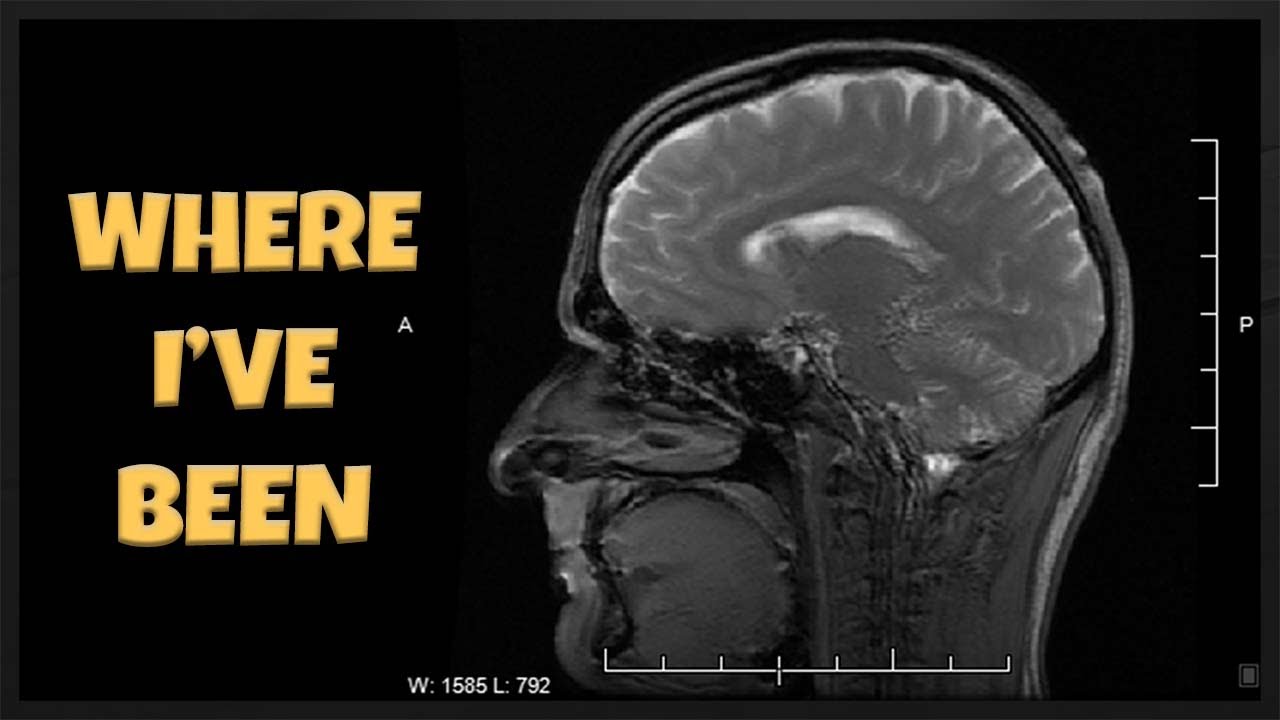 Where I've Been - Health & Mental Health Updates