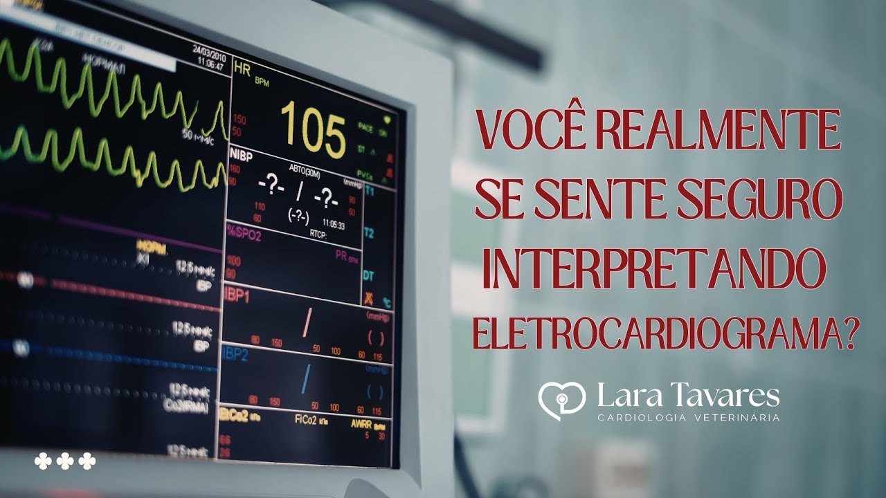 Você Se Sente Seguro Interpretando Eletrocardiograma?