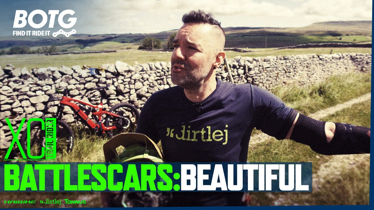 🌲 MTB Yorkshire Dales. Battle Scars @Horton in Ribblesdale.