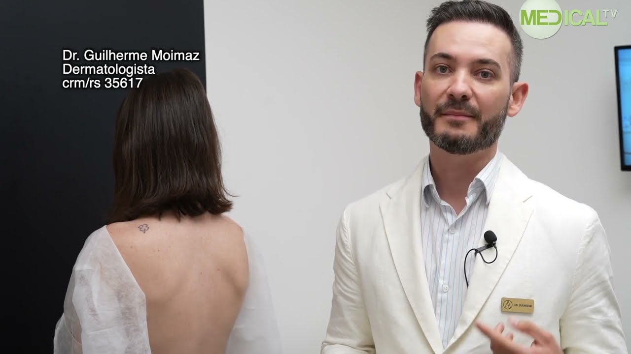 O diagnóstico do Melanoma - Mapeamento corporal (Fotofinder)