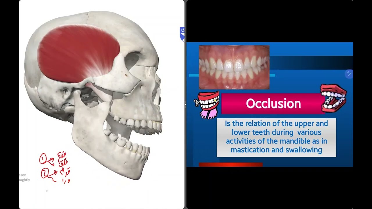 Dental Anatomy SU Revision Capsoules Dental Occlusion | جامعة سيناء دنتال أناتومي - الأوكلوجن