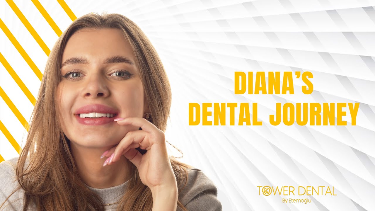 Diana's Dental Journey | Tower Dental Clinic