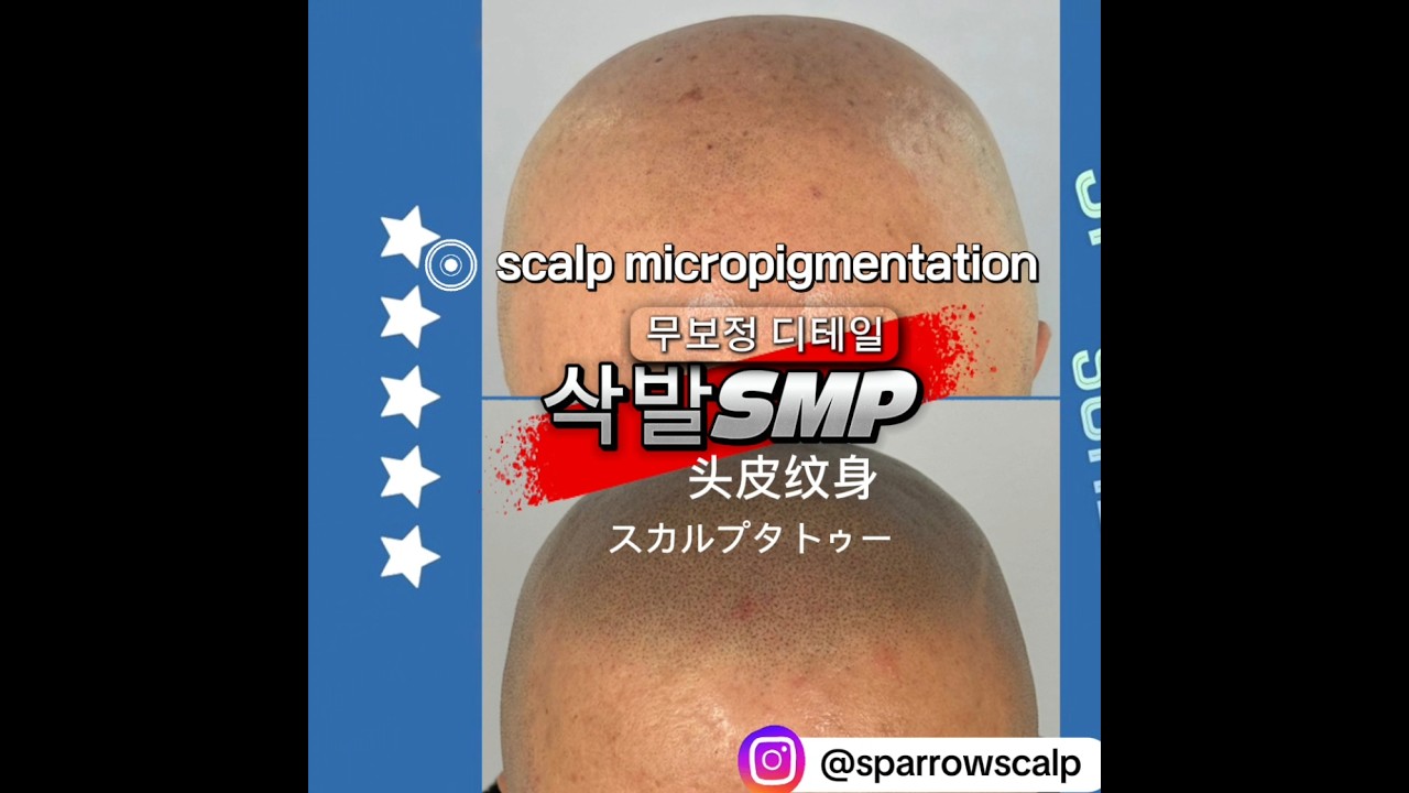 #smp삭발